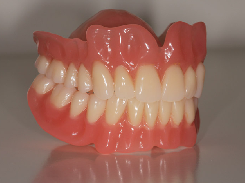 Queens Drive Dental Surgery Liverpool Acrylic Denture